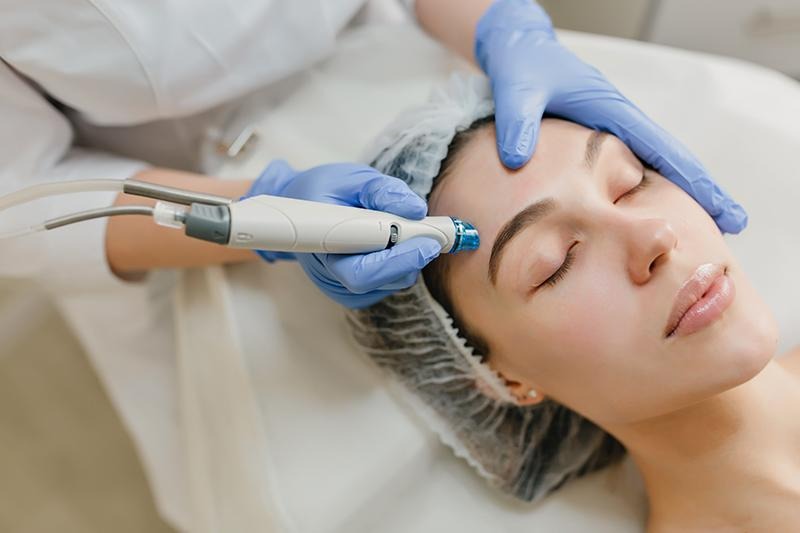 Pre- and Post-Treatment Care for Skin Needling: A Practitioner’s Guide